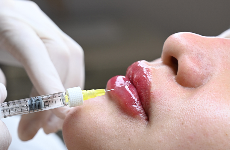Treatment by Dr. Batoul Reffai