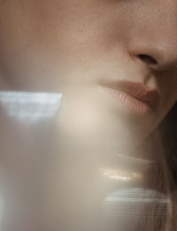 Before cheek filler treatment