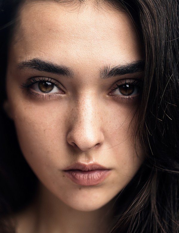 Before sculptra treatment